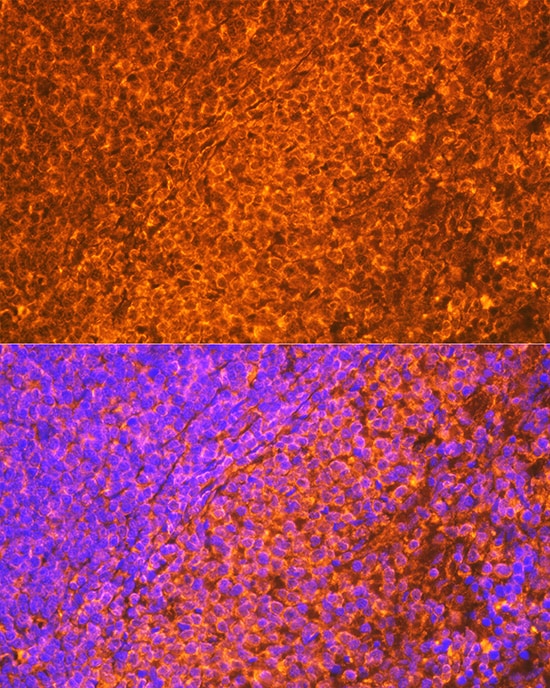 EBI3 Antibody (9J1H4)