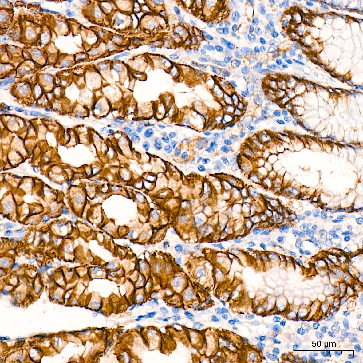 CTNNA3 Antibody (8F1U7)