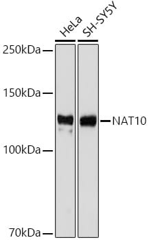 NAT10 Antibody (5Z3E5)