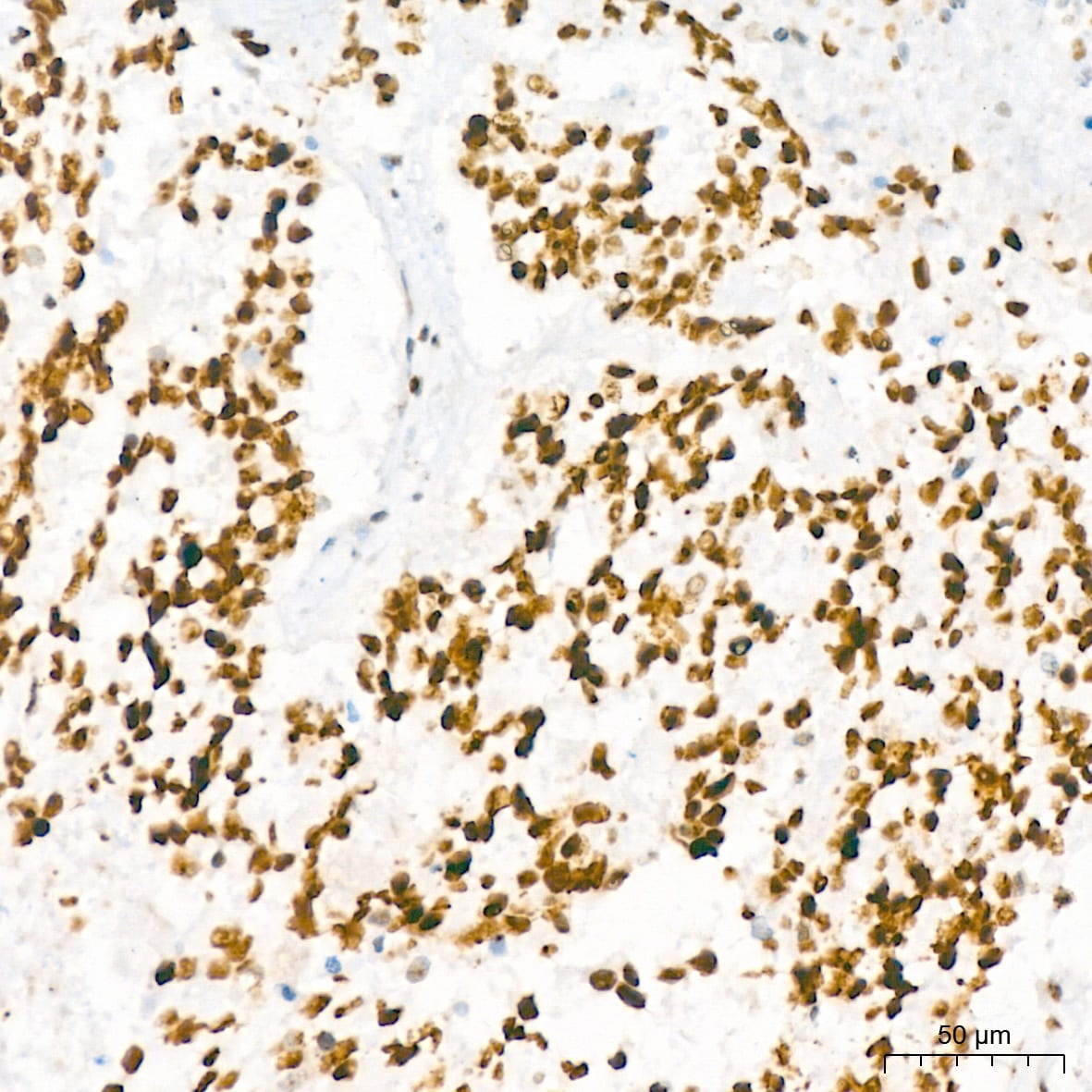 NAT10 Antibody (5Z3E5)