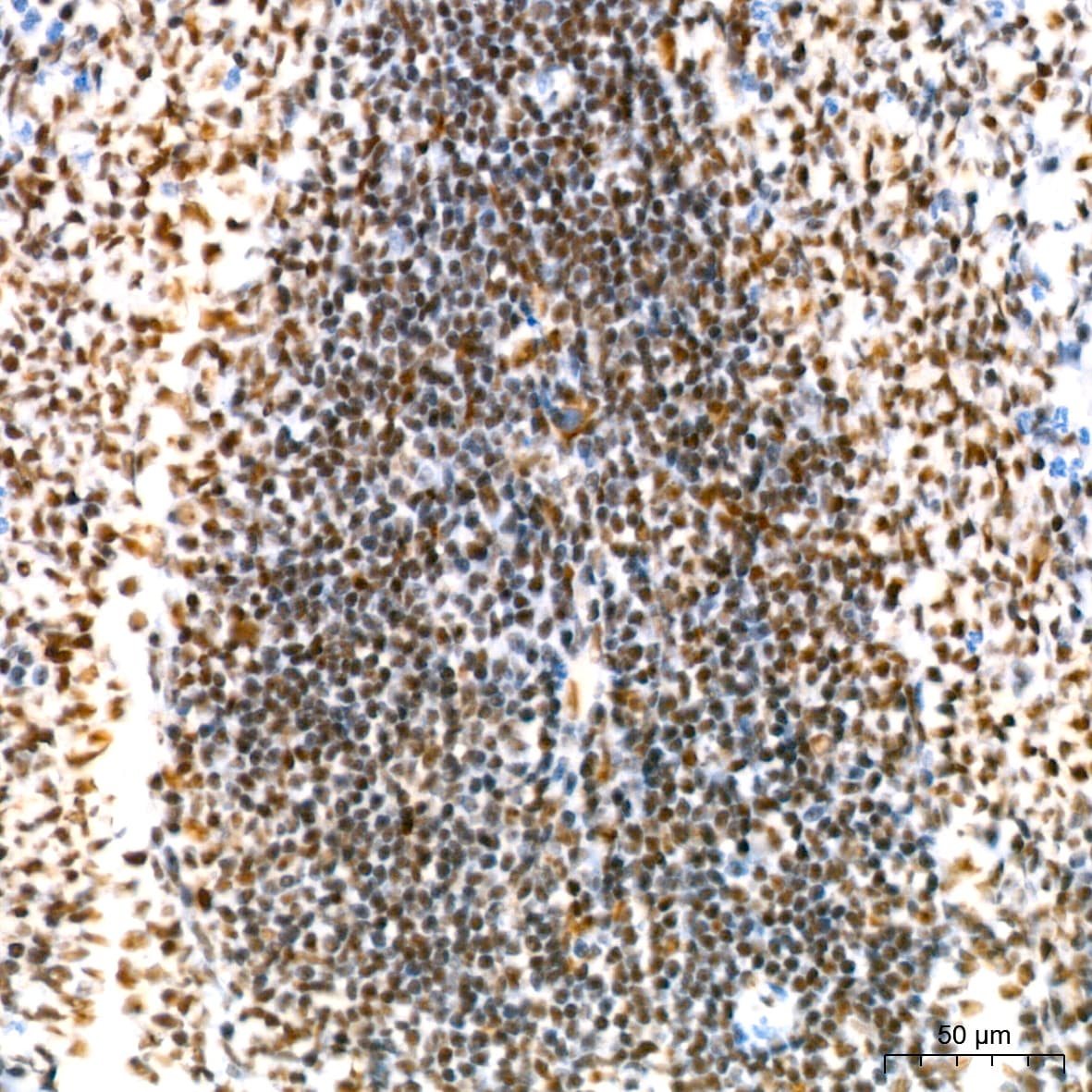 NAT10 Antibody (5Z3E5)