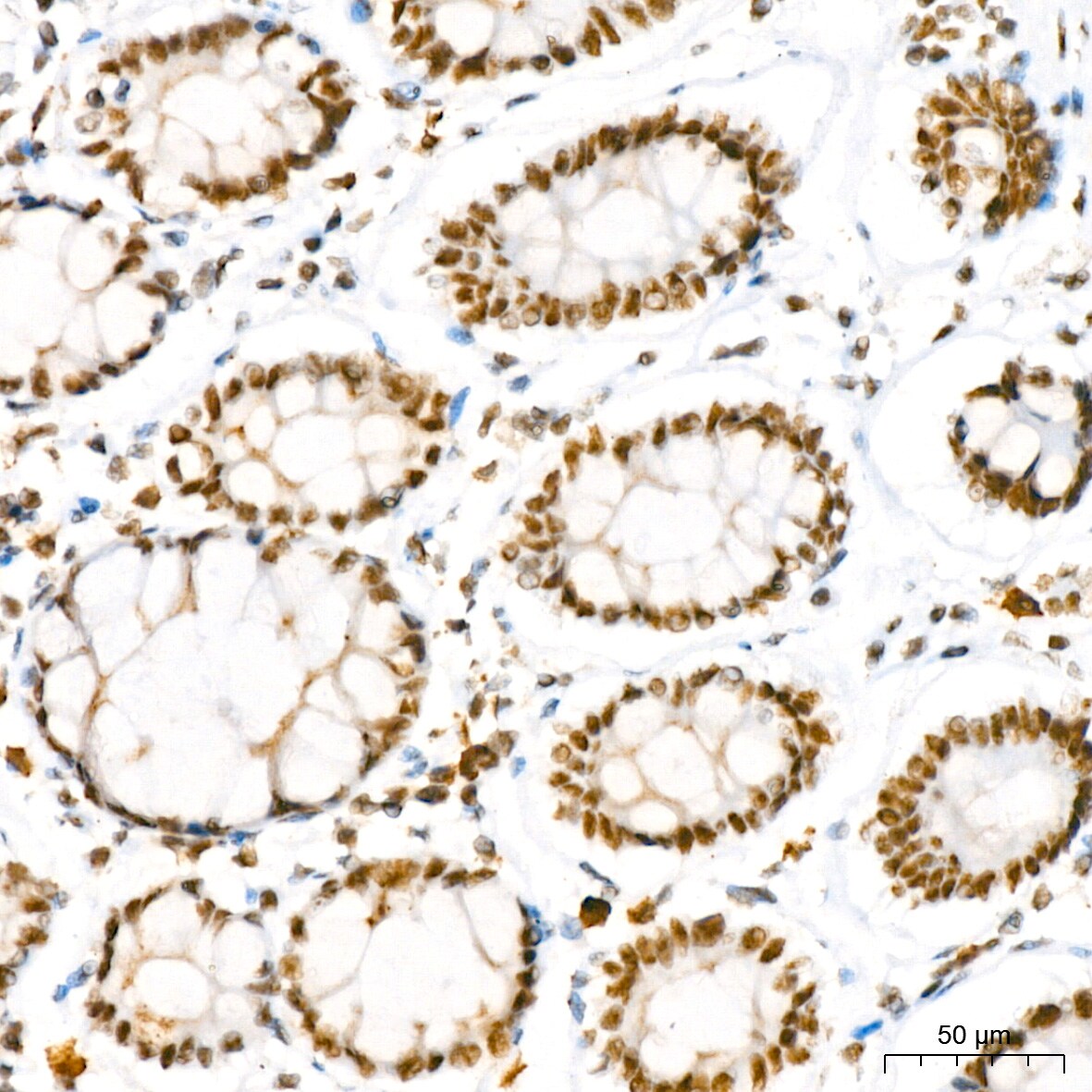 NAT10 Antibody (5Z3E5)