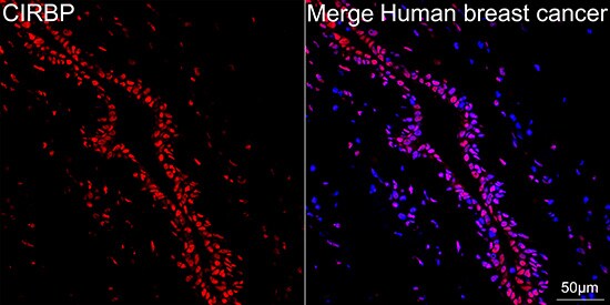 CIRBP Antibody (3V9S7)