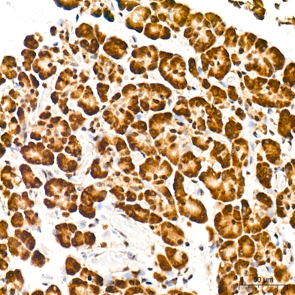 CIRBP Antibody (3V9S7)