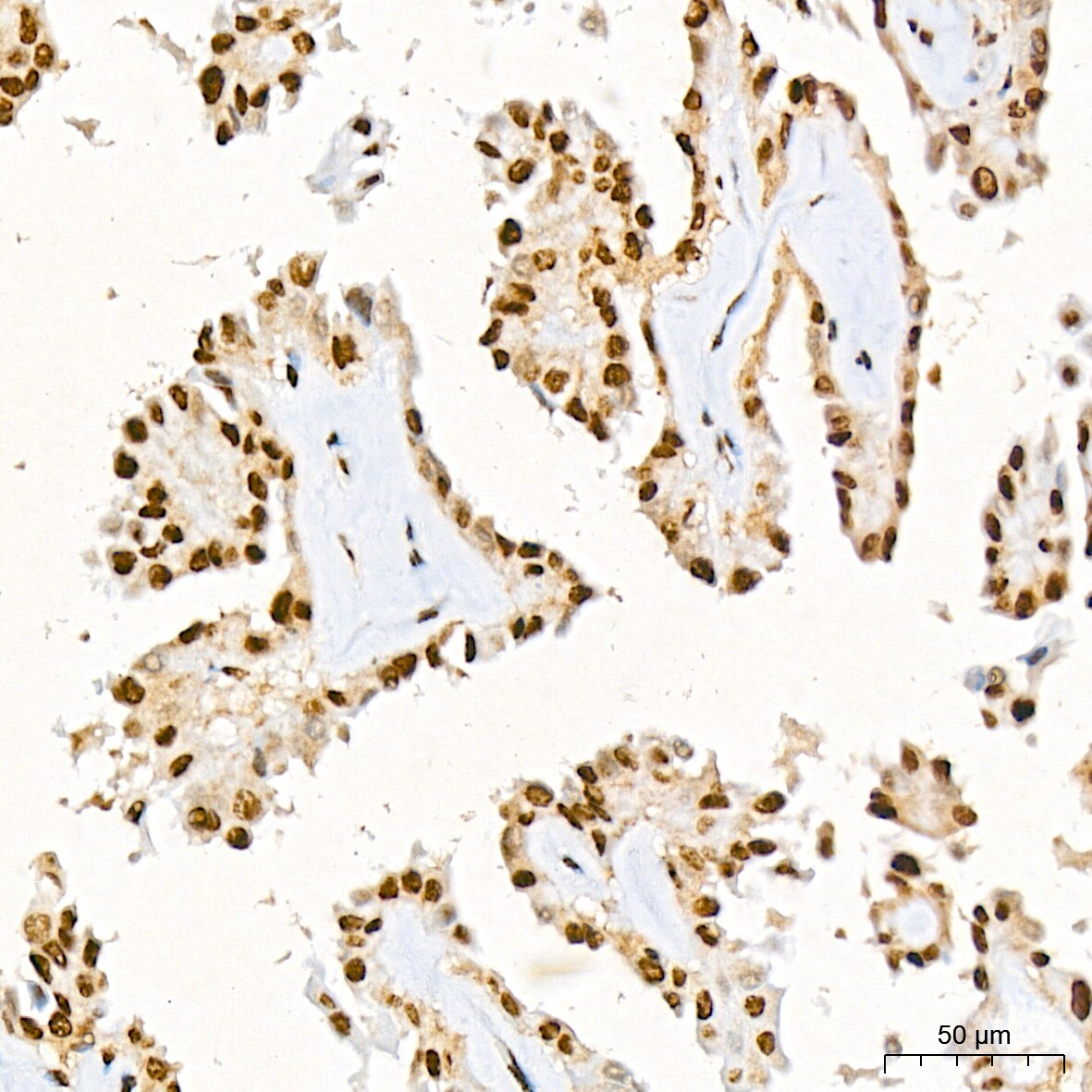 CIRBP Antibody (3V9S7)