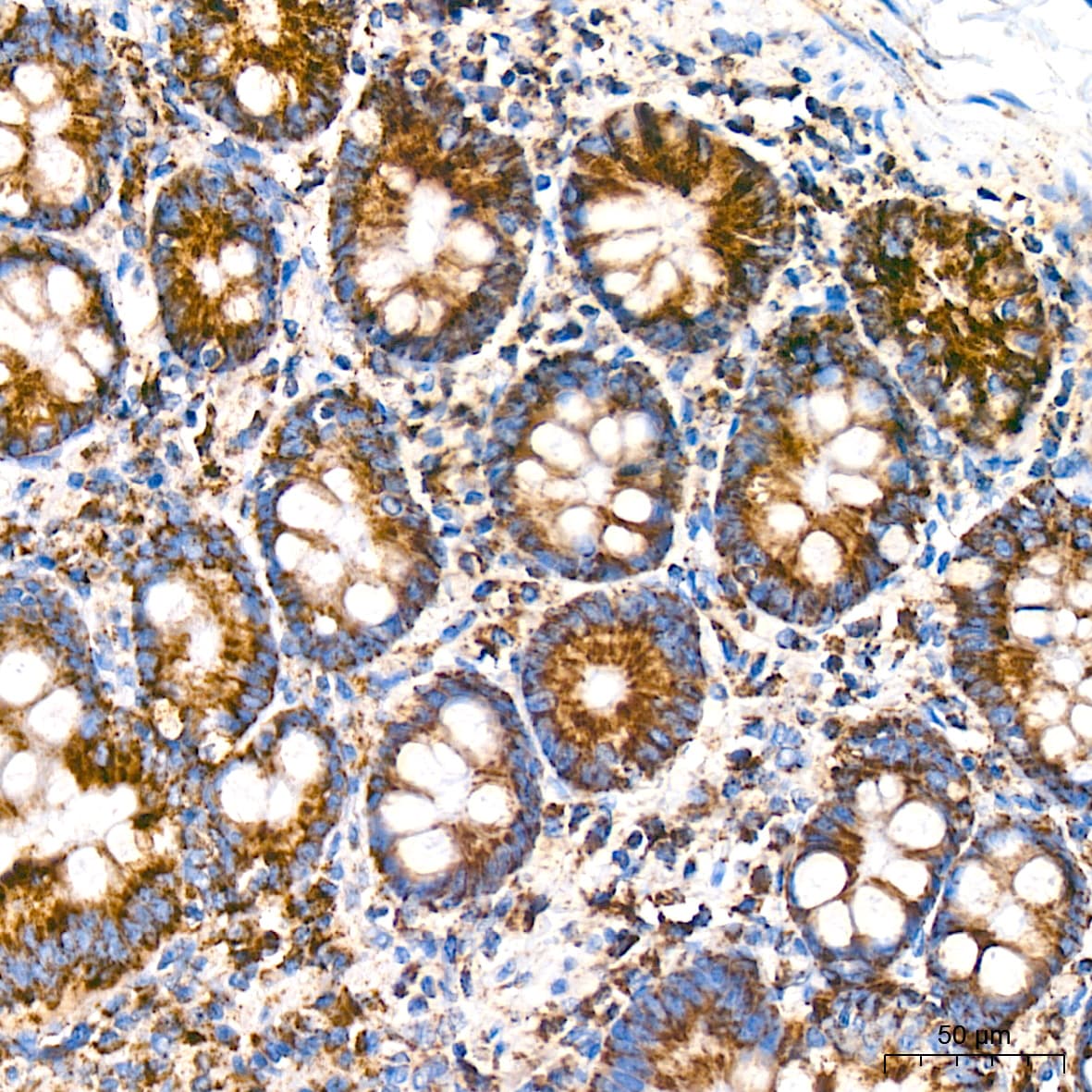 Bcl G Antibody (6R9F3)