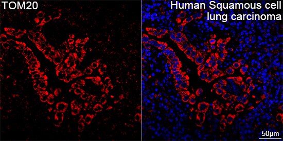 TOMM20 Antibody (10G6I8)