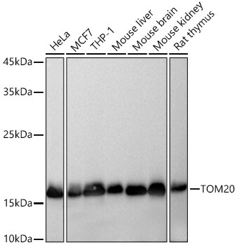 TOMM20 Antibody (10G6I8)