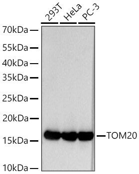 TOMM20 Antibody (10G6I8)