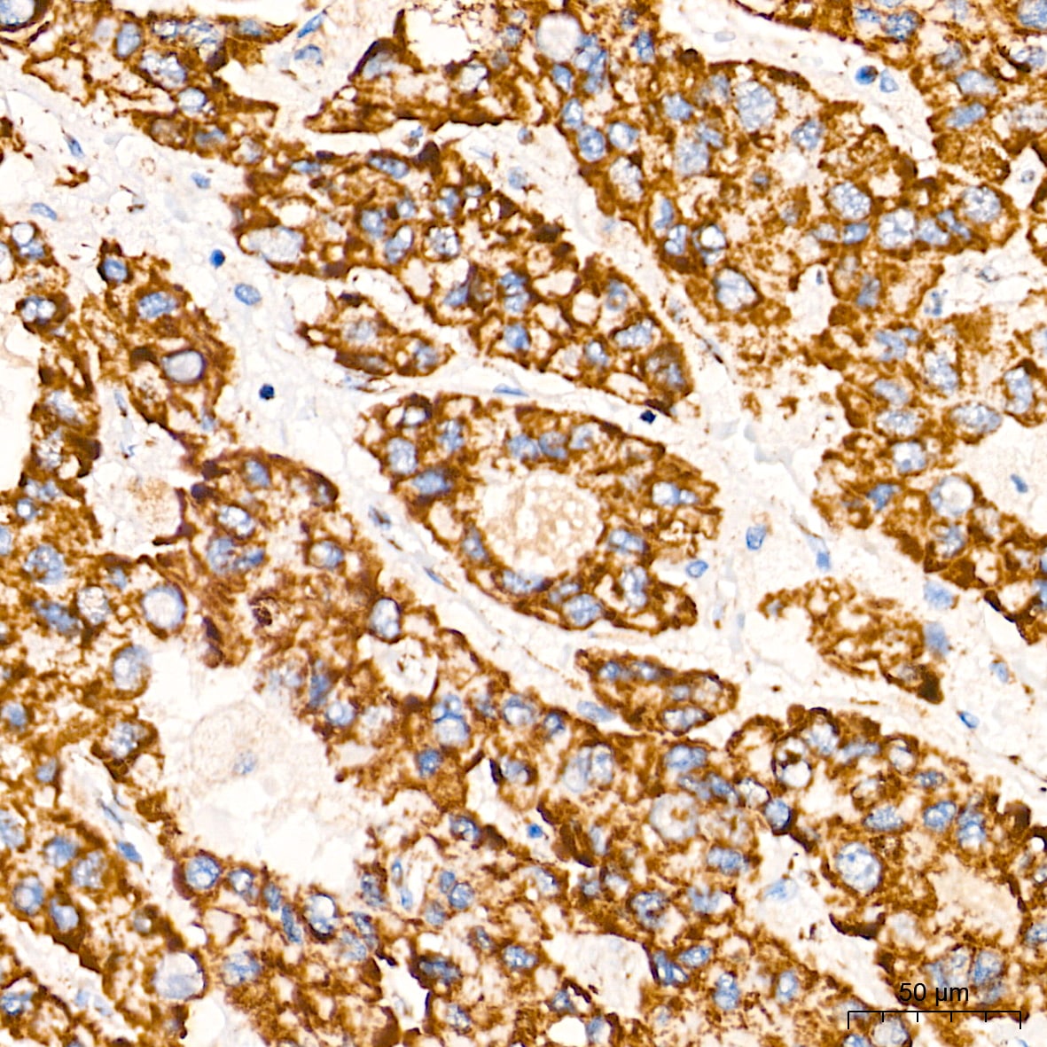 TOMM20 Antibody (10G6I8)