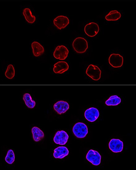 Lamin A + C Antibody (4L8Q0)