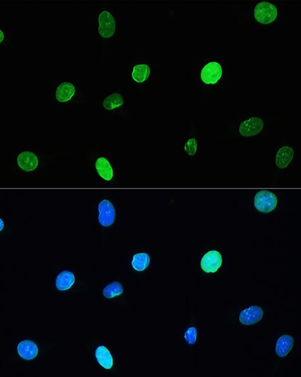 Lamin A + C Antibody (4L8Q0)