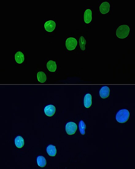 Lamin A + C Antibody (4L8Q0)