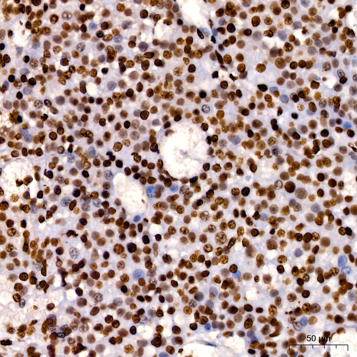 HMGB1/HMG-1 Antibody (1C4T5)