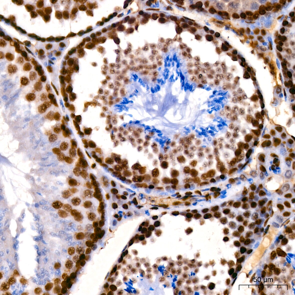 HMGB1/HMG-1 Antibody (1C4T5)