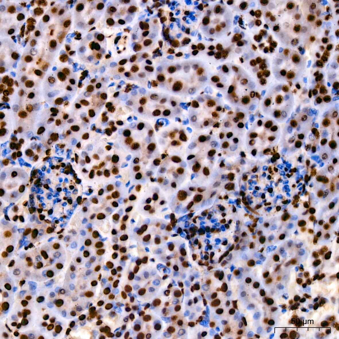 HMGB1/HMG-1 Antibody (1C4T5)