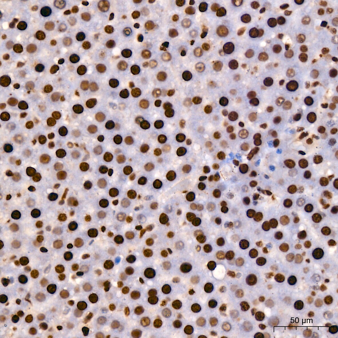 HMGB1/HMG-1 Antibody (1C4T5)