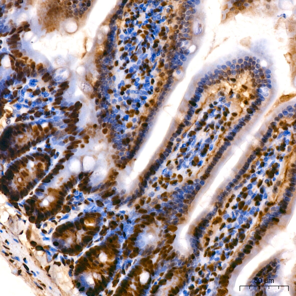 HMGB1/HMG-1 Antibody (1C4T5)