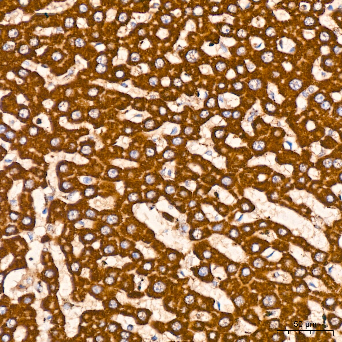 Prohibitin Antibody (0V2R10)