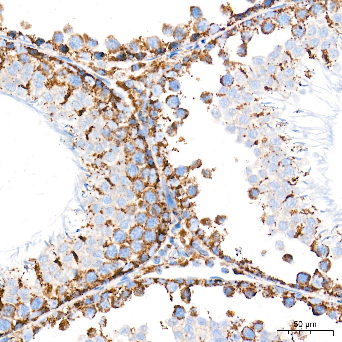 AIF Antibody (5F0Y1)
