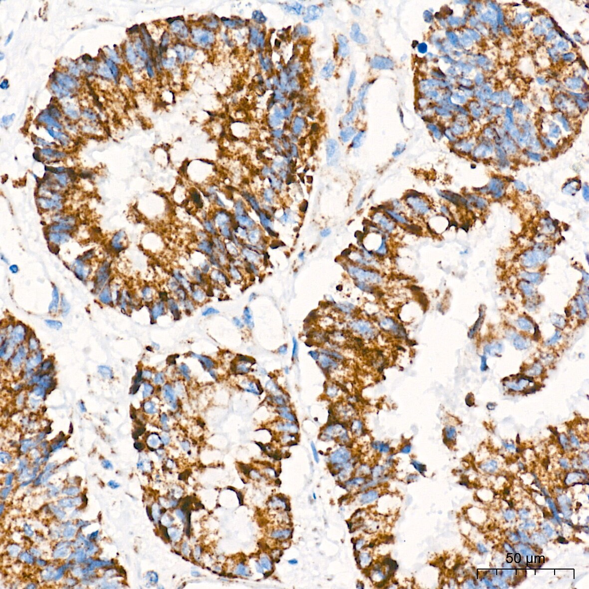 AIF Antibody (5F0Y1)