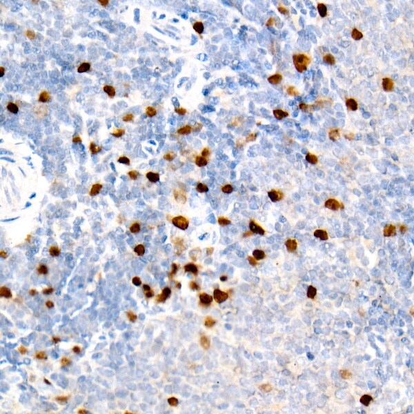 Aurora B Antibody (3C4V8)