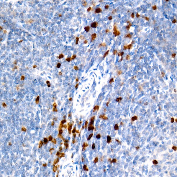 Aurora B Antibody (3C4V8)