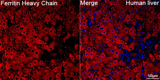 Ferritin Heavy Chain Antibody (1Q10I7)