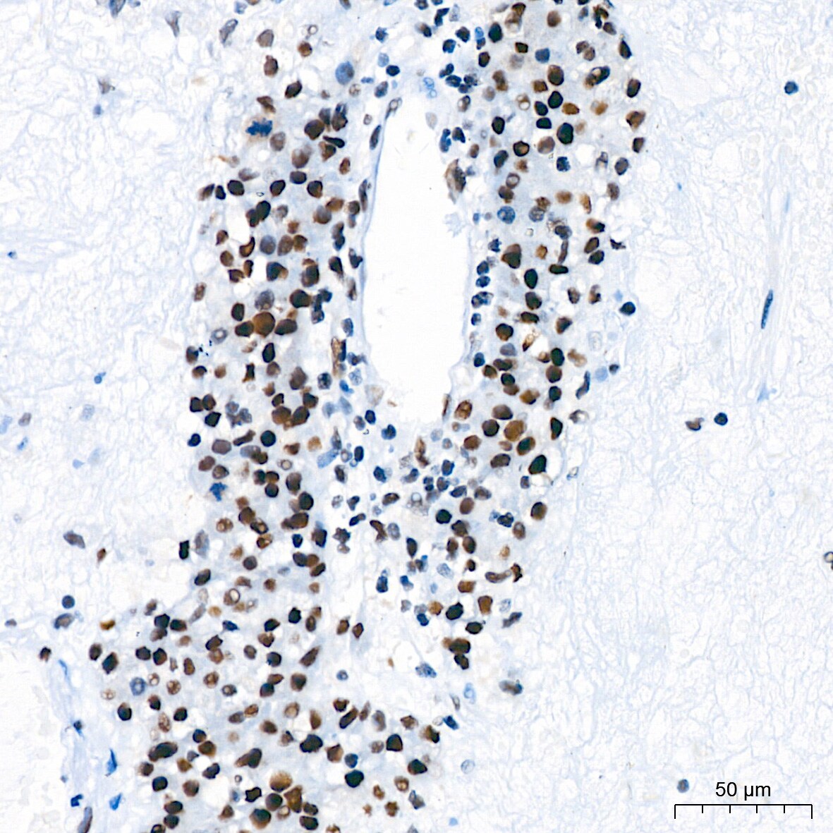 TCF7L2 Antibody (1W10T6)