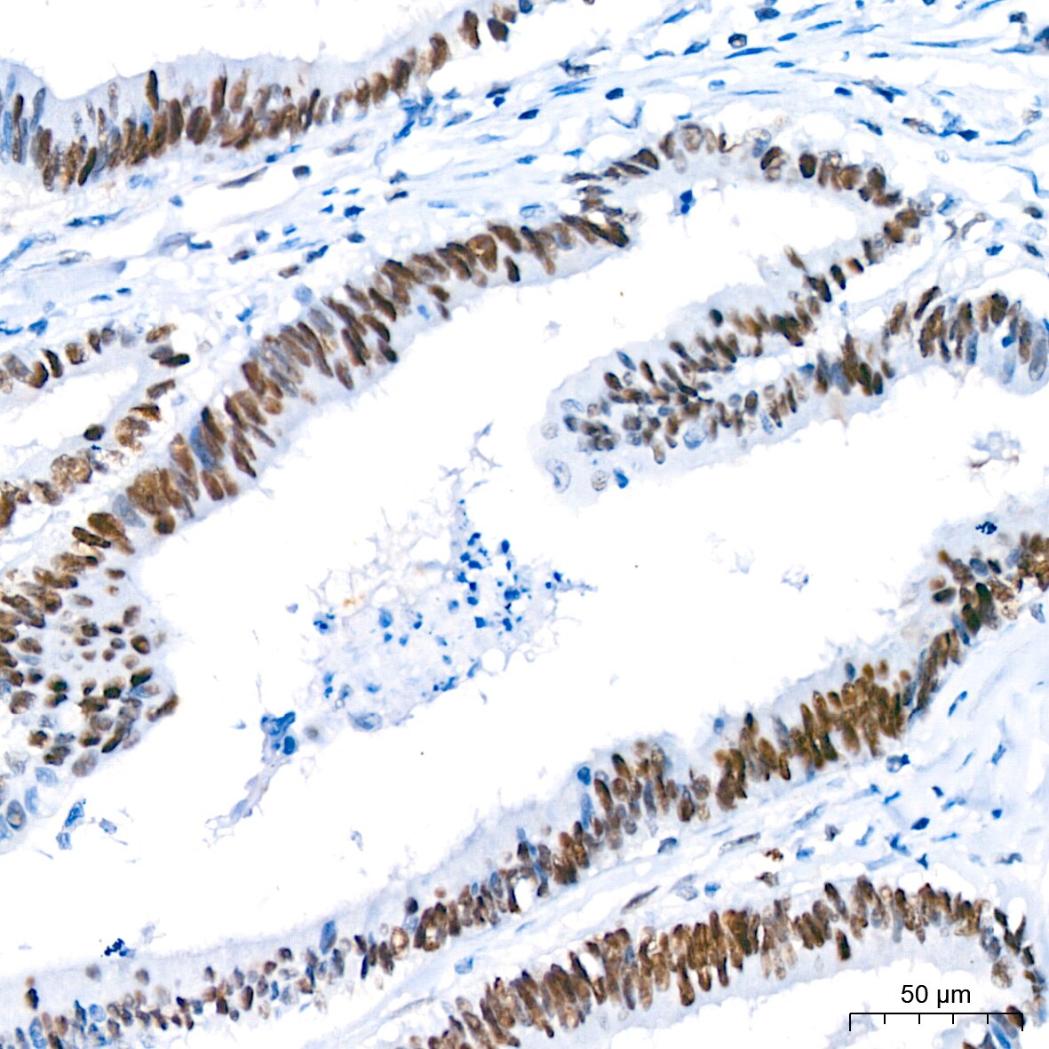 TCF7L2 Antibody (1W10T6)
