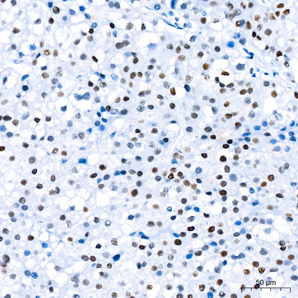 TCF7L2 Antibody (1W10T6)
