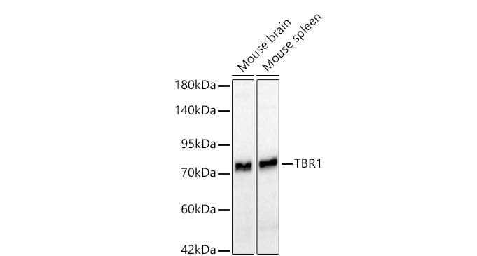 TBR1 Antibody (1U1K5)