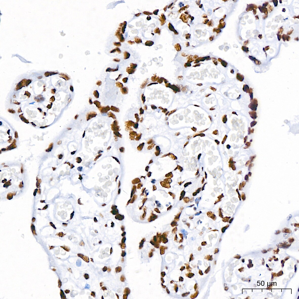 Brg1 Antibody (4N9C4)