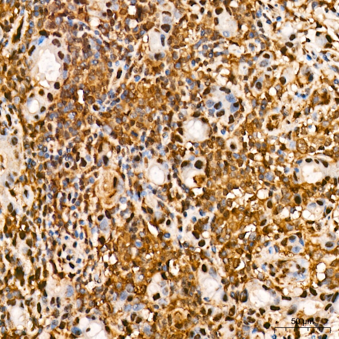 ERK1 Antibody (0B0C1)