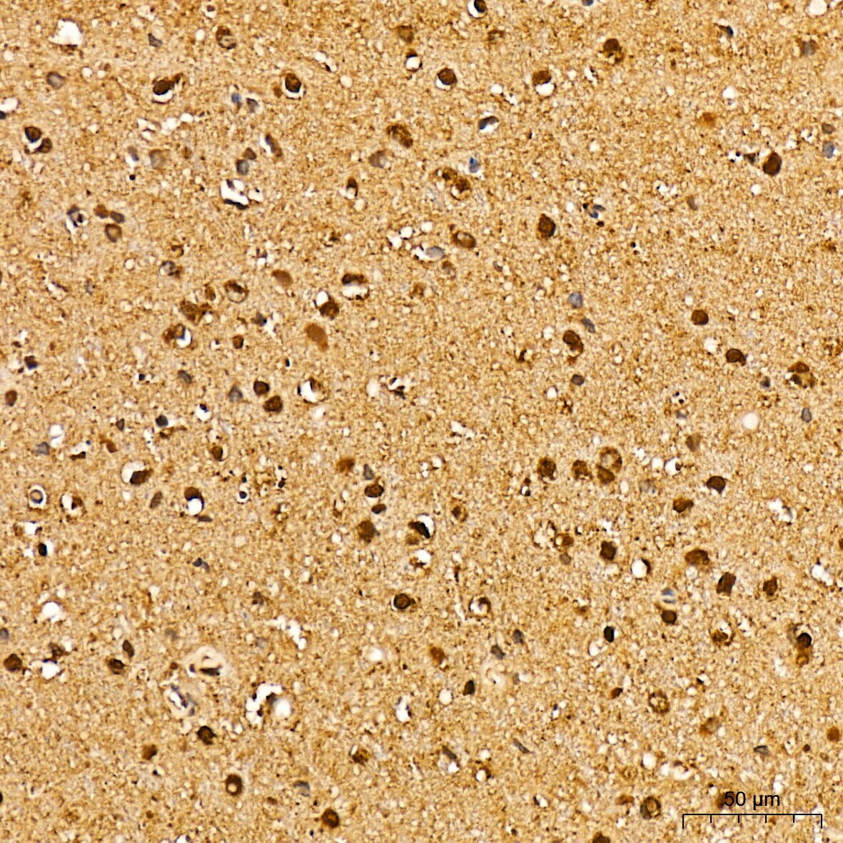 ERK1 Antibody (0B0C1)