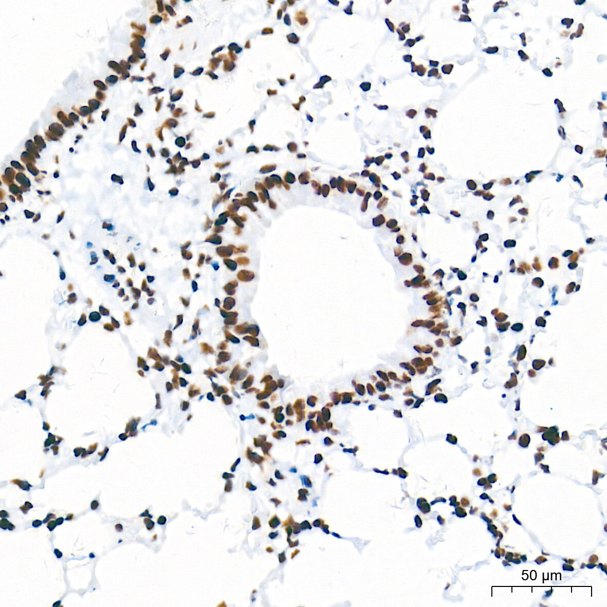 HDAC1 Antibody (2L6O7)