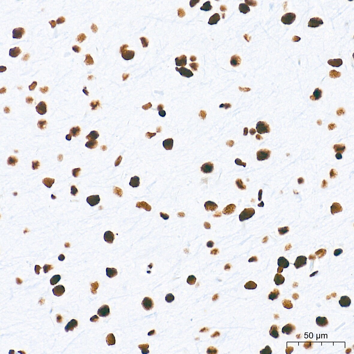 HDAC1 Antibody (2L6O7)