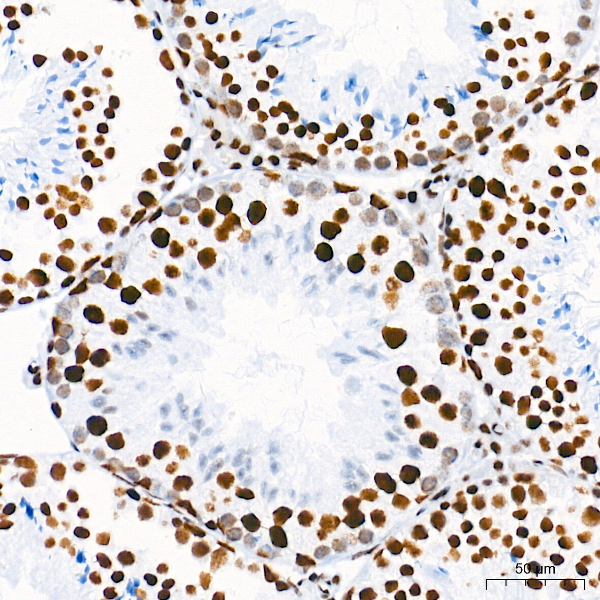 HDAC1 Antibody (2L6O7)
