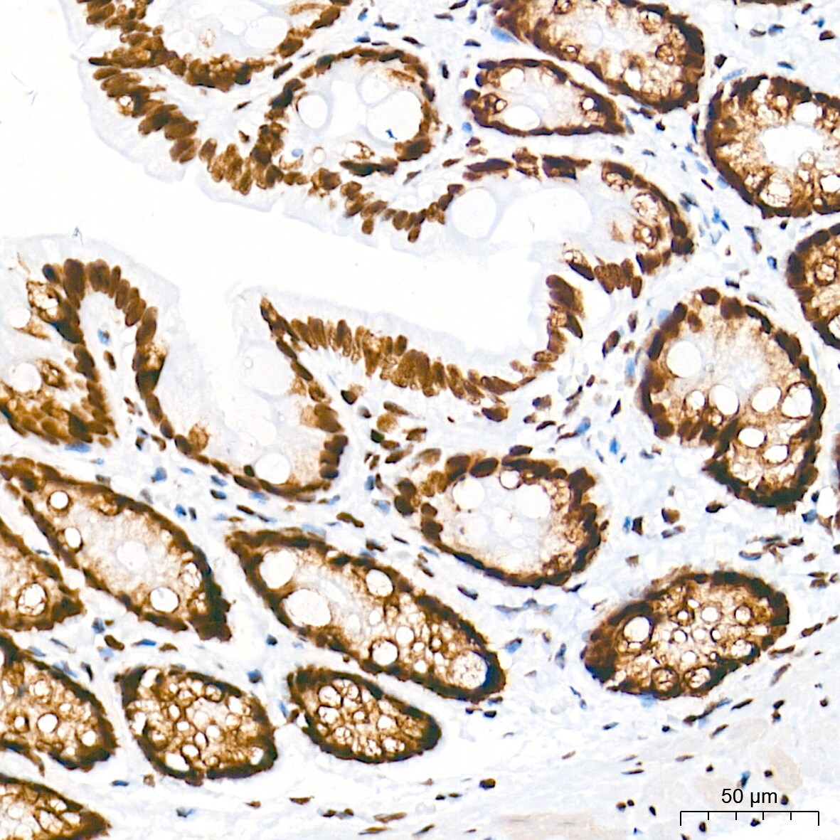 HDAC1 Antibody (2L6O7)