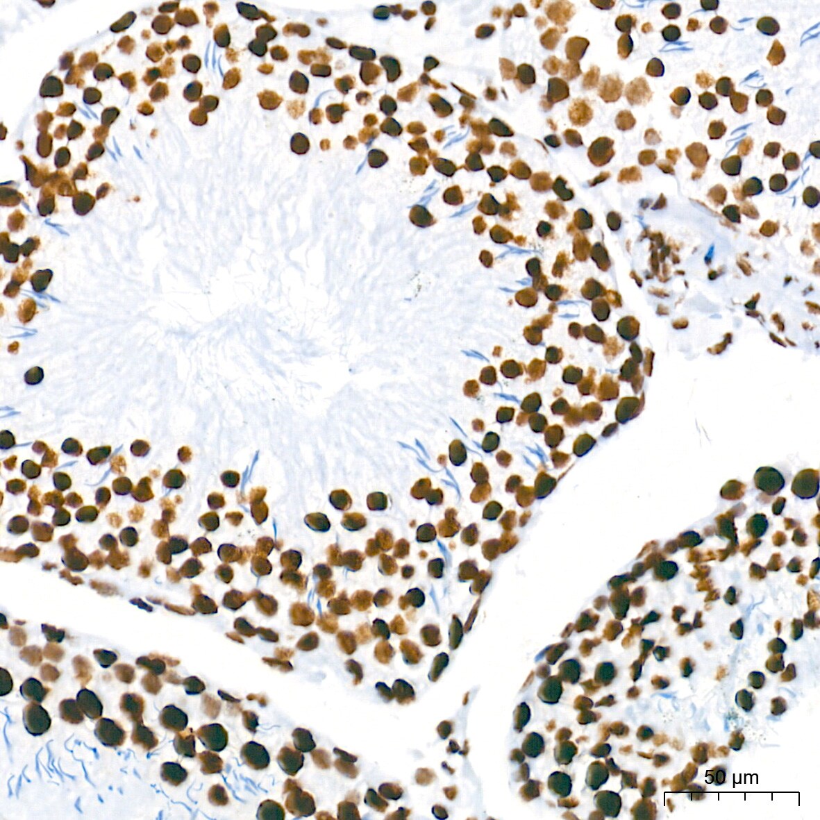 HDAC1 Antibody (2L6O7)