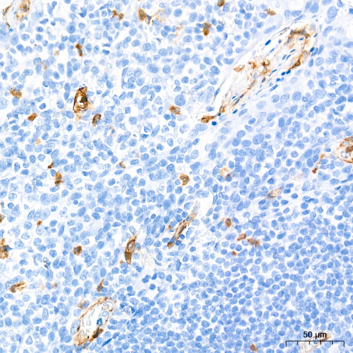 Dysferlin Antibody (3U1P9)