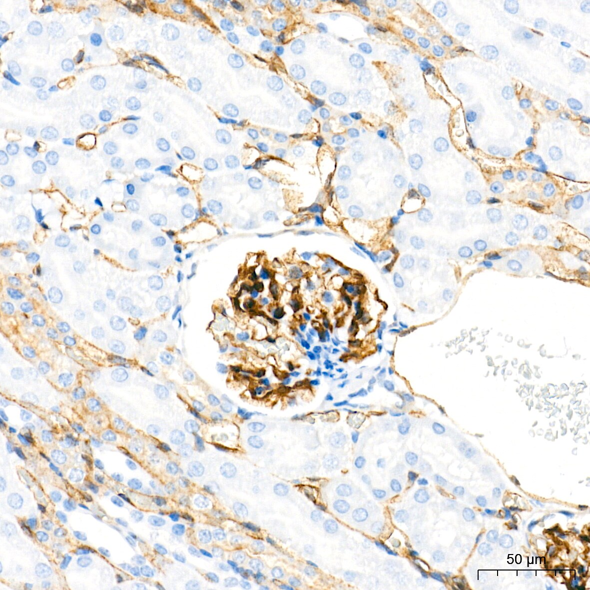 Dysferlin Antibody (3U1P9)