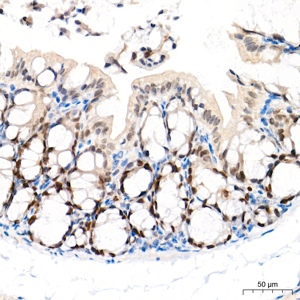 EZH2/KMT6 Antibody (9Q2R9)
