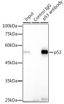p53 Antibody (9D6F7)