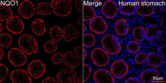 NQO-1 Antibody (9M3H10)
