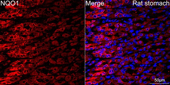 NQO-1 Antibody (9M3H10)