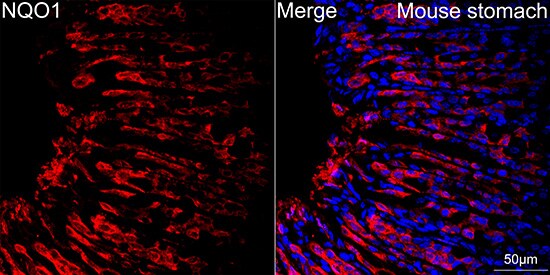 NQO-1 Antibody (9M3H10)