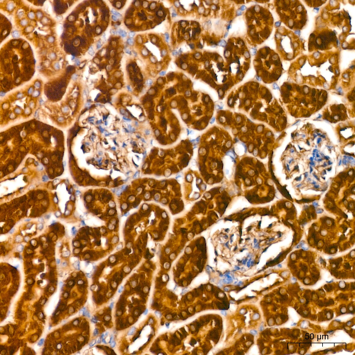 ATG3/APG3 Antibody (5D2W0)