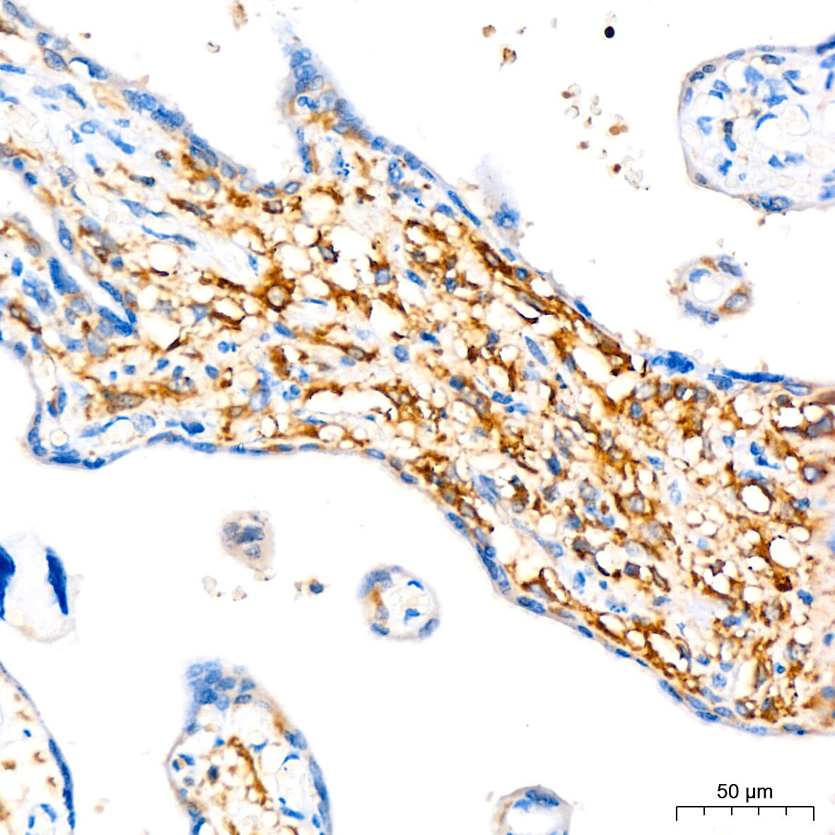 ATG3/APG3 Antibody (5D2W0)