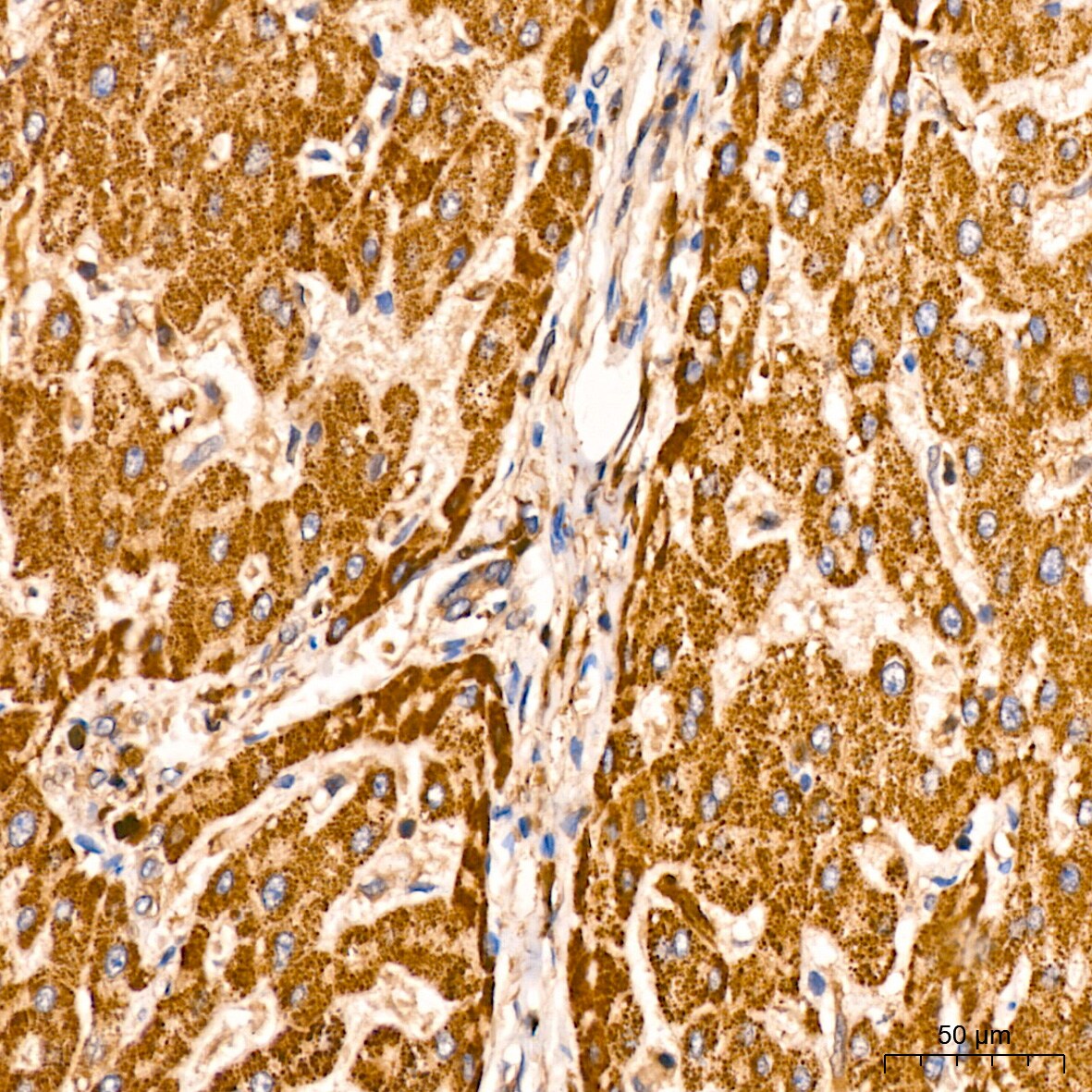 ATG3/APG3 Antibody (5D2W0)